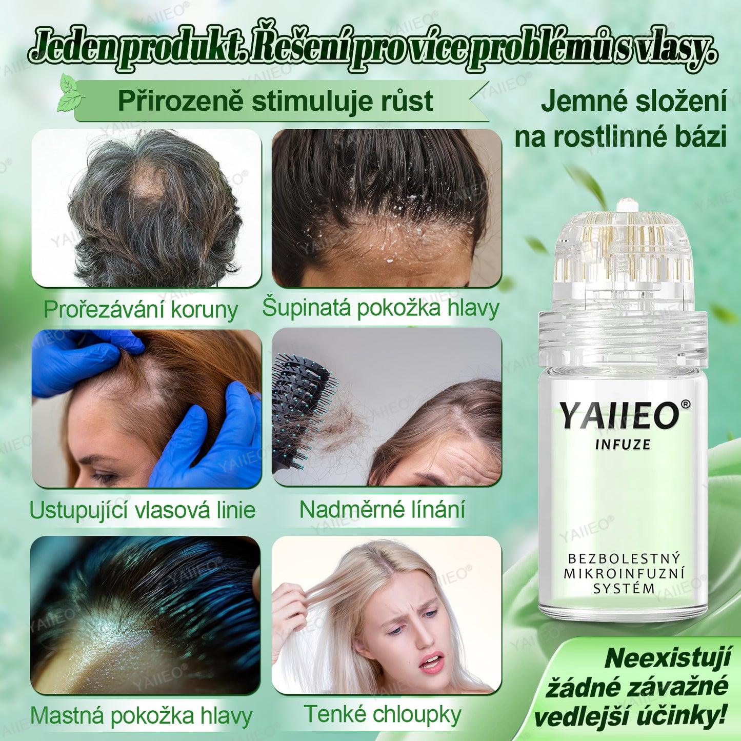 🍌𝐘𝐀𝐈𝐈𝐄𝐎® 𝑭á𝒋𝒅𝒂𝒍𝒐𝒎𝒎𝒆𝒏𝒕𝒆𝒔 𝑴𝒊𝒌𝒓𝒏💛 𝑹𝒆𝒏𝒅𝒔𝒛𝒆𝒓 Hluboce působící blokování DHT, reaktivace vlasových folikulů a viditelný růst vlasů