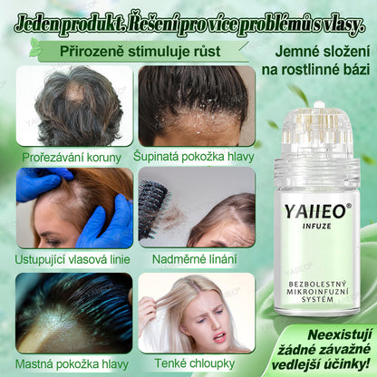 🍌𝐘𝐀𝐈𝐈𝐄𝐎® 𝑭á𝒋𝒅𝒂𝒍𝒐𝒎𝒎𝒆𝒏𝒕𝒆𝒔 𝑴𝒊𝒌𝒓𝒏💛 𝑹𝒆𝒏𝒅𝒔𝒛𝒆𝒓 Hluboce působící blokování DHT, reaktivace vlasových folikulů a viditelný růst vlasů
