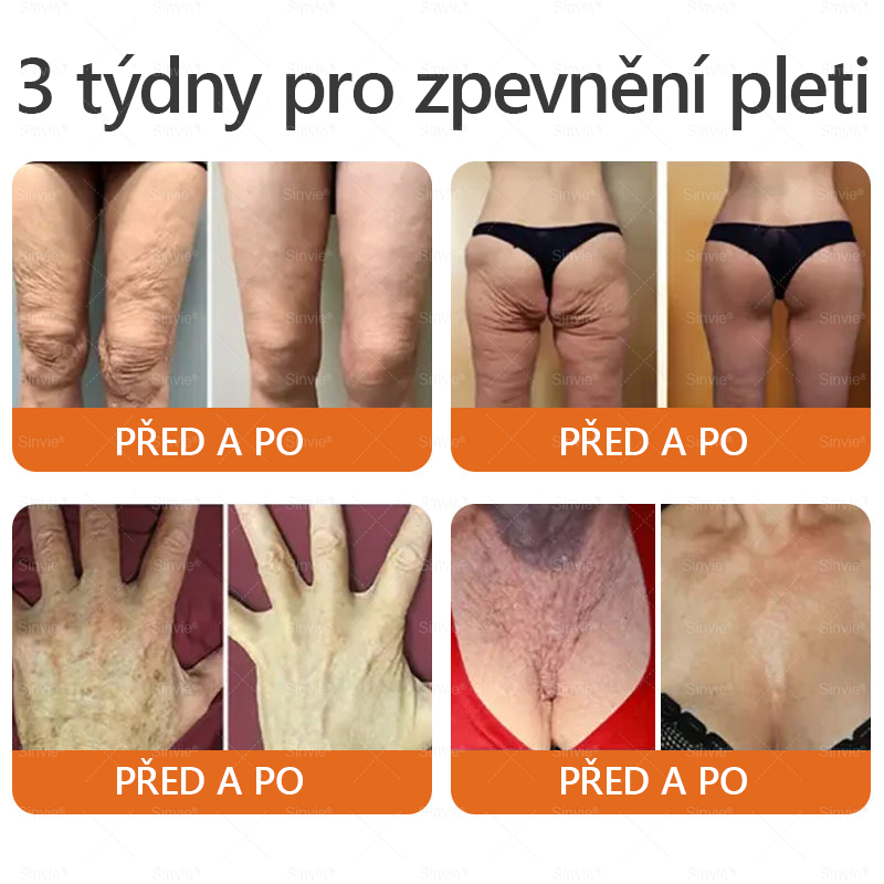 🎁 Zbývá už jen 5 krabiček. Nabízíme vám dodatečnou 70% slevu! Udržujte si zdravou postavu. Pokud to teď propásnete, příští rok už nebudete mít šanci.