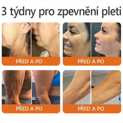 🎁 Zbývá už jen 5 krabiček. Nabízíme vám dodatečnou 70% slevu! Udržujte si zdravou postavu. Pokud to teď propásnete, příští rok už nebudete mít šanci.