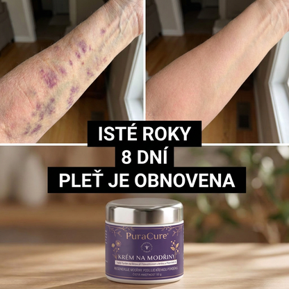 🍃🍃 100 000+ PRODANÝCH KUSŮ 💁‍♀️ – PuraCure® Krém na modřiny a posílení pokožky