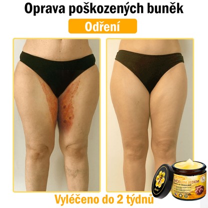 🍎 Sinvie® Krém na obnovu pleti s včelím jedem(👨‍⚕‍Výroba probíhá v souladu s normami GMP)👍✅