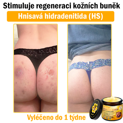 🍎 Sinvie® Krém na obnovu pleti s včelím jedem(👨‍⚕‍Výroba probíhá v souladu s normami GMP)👍✅