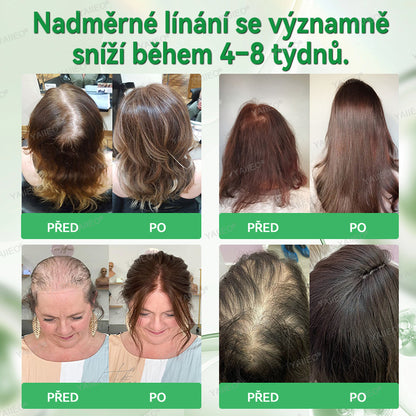 🍌𝐘𝐀𝐈𝐈𝐄𝐎® 𝑭á𝒋𝒅𝒂𝒍𝒐𝒎𝒎𝒆𝒏𝒕𝒆𝒔 𝑴𝒊𝒌𝒓𝒏💛 𝑹𝒆𝒏𝒅𝒔𝒛𝒆𝒓 Hluboce působící blokování DHT, reaktivace vlasových folikulů a viditelný růst vlasů
