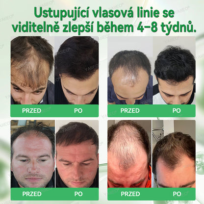 🌿𝒀𝑨𝑰𝑰𝑬𝑶® 𝑺é𝒓𝒖𝒎 𝒑𝒓𝒐 𝒑𝒐𝒅𝒑𝒐𝒓𝒖 𝒓ů𝒔𝒕𝒖 𝒗𝒍𝒂𝒔ů – 𝑱𝒆𝒎𝒏á 𝒂 𝒃𝒆𝒛𝒃𝒐𝒍𝒆𝒔𝒕𝒏á  𝒑éč𝒆