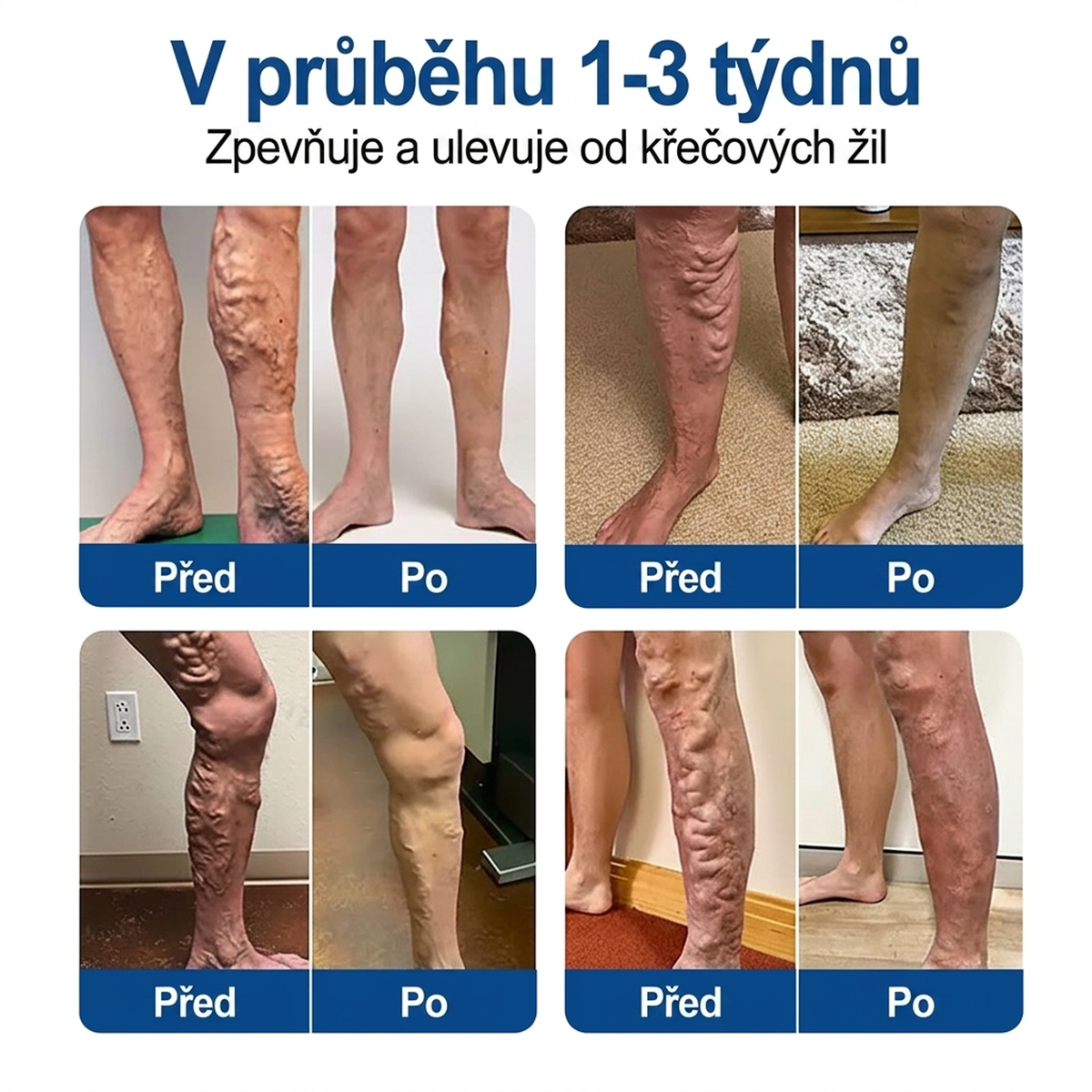 🌿✅ Medistart® VeinRepair Microneedle Care Patch ⚡ Okamžitá úleva, dlouhodobé výsledky