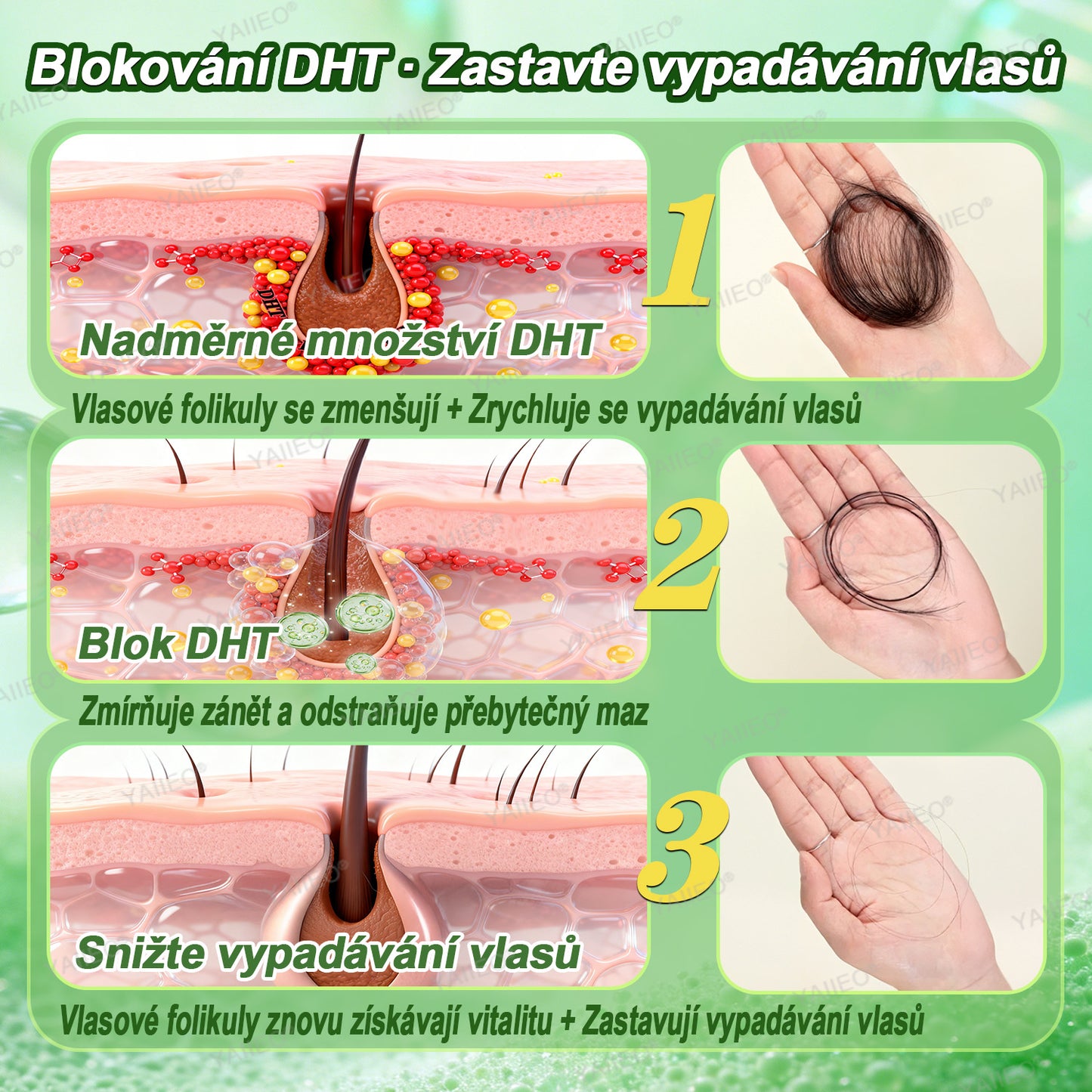 🍌𝐘𝐀𝐈𝐈𝐄𝐎® 𝑭á𝒋𝒅𝒂𝒍𝒐𝒎𝒎𝒆𝒏𝒕𝒆𝒔 𝑴𝒊𝒌𝒓𝒏💛 𝑹𝒆𝒏𝒅𝒔𝒛𝒆𝒓 Hluboce působící blokování DHT, reaktivace vlasových folikulů a viditelný růst vlasů
