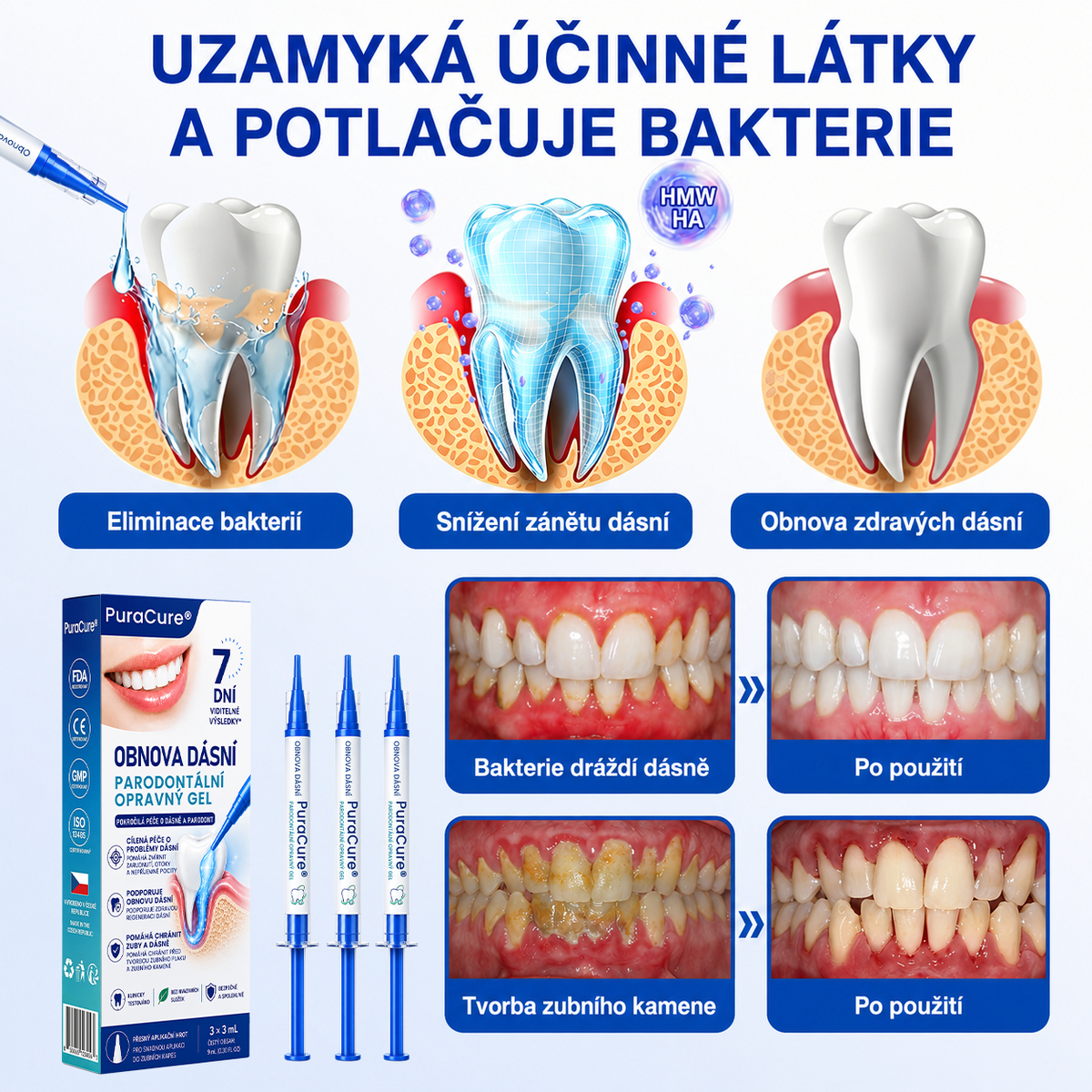 🦷 𝐏𝐮𝐫𝐚𝐂𝐮𝐫𝐞®  𝐎𝐛𝐧𝐨𝐯𝐚 𝐝á𝐬𝐧í 𝐩𝐚𝐫𝐨𝐝𝐨𝐧𝐭á𝐥𝐧í 𝐨𝐩𝐫𝐚𝐯𝐧ý 𝐠𝐞𝐥