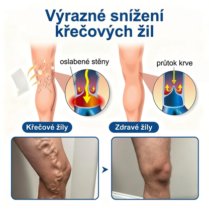 🌿✅ Medistart® VeinRepair Microneedle Care Patch ⚡ Okamžitá úleva, dlouhodobé výsledky