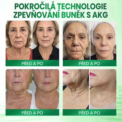 🍃🍃Medistart® AKG ZPEVŇUJÍCÍ PÉČE O PLEŤ & PROTI STÁRNUTÍ