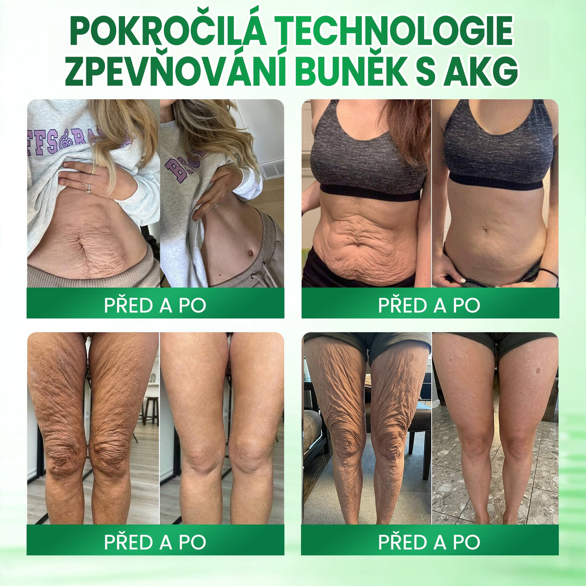 🍃🍃Medistart® AKG ZPEVŇUJÍCÍ PÉČE O PLEŤ & PROTI STÁRNUTÍ