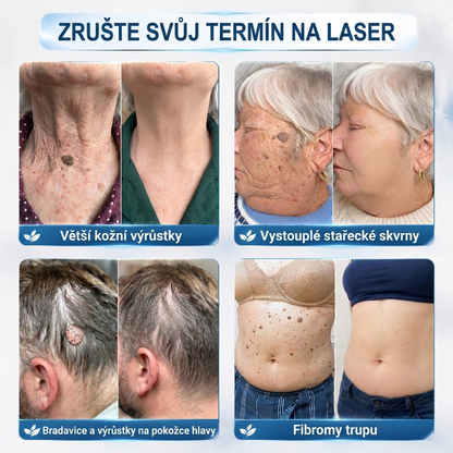 🍃PuraCure® 👩‍⚕️ 𝟕denní Pero na Odstranění Kožních Výrůstků a Skvrn – Bezbolestné Odstranění bez Jizev, Profesionální Roller aplikátor