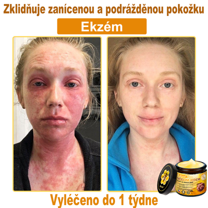 🍎 Sinvie® Krém na obnovu pleti s včelím jedem(👨‍⚕‍Výroba probíhá v souladu s normami GMP)👍✅