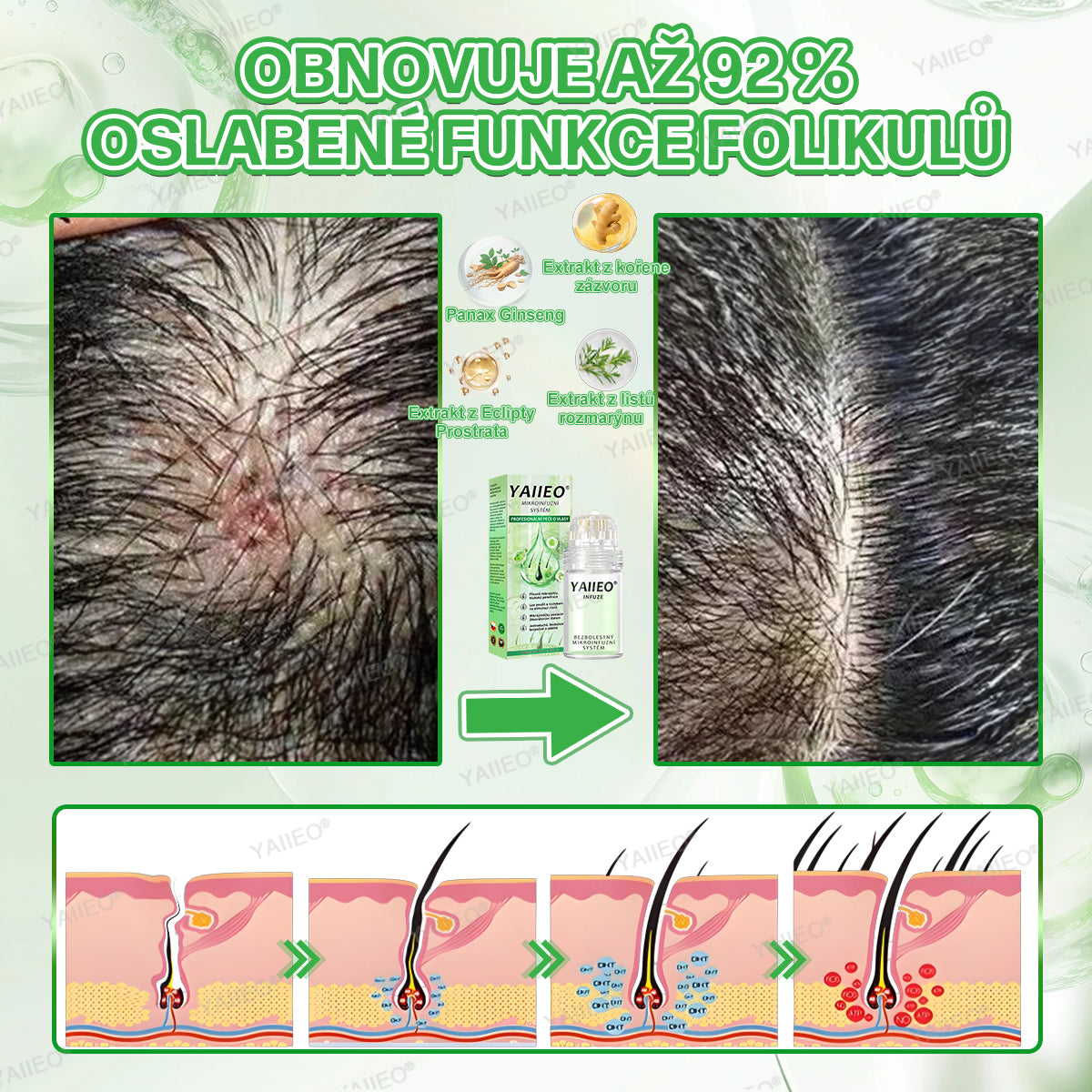 🍌𝐘𝐀𝐈𝐈𝐄𝐎® 𝑭á𝒋𝒅𝒂𝒍𝒐𝒎𝒎𝒆𝒏𝒕𝒆𝒔 𝑴𝒊𝒌𝒓𝒏💛 𝑹𝒆𝒏𝒅𝒔𝒛𝒆𝒓 Hluboce působící blokování DHT, reaktivace vlasových folikulů a viditelný růst vlasů