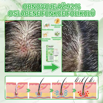 🍌𝐘𝐀𝐈𝐈𝐄𝐎® 𝑭á𝒋𝒅𝒂𝒍𝒐𝒎𝒎𝒆𝒏𝒕𝒆𝒔 𝑴𝒊𝒌𝒓𝒏💛 𝑹𝒆𝒏𝒅𝒔𝒛𝒆𝒓 Hluboce působící blokování DHT, reaktivace vlasových folikulů a viditelný růst vlasů