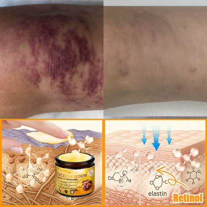 🎁 Zbývá už jen 5 krabiček. Nabízíme vám dodatečnou 70% slevu! Udržujte si zdravou postavu. Pokud to teď propásnete, příští rok už nebudete mít šanci.