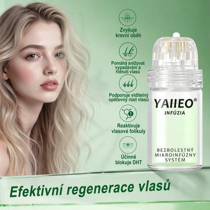 🍌𝐘𝐀𝐈𝐈𝐄𝐎® 𝑭á𝒋𝒅𝒂𝒍𝒐𝒎𝒎𝒆𝒏𝒕𝒆𝒔 𝑴𝒊𝒌𝒓𝒏💛 𝑹𝒆𝒏𝒅𝒔𝒛𝒆𝒓 Hluboce působící blokování DHT, reaktivace vlasových folikulů a viditelný růst vlasů