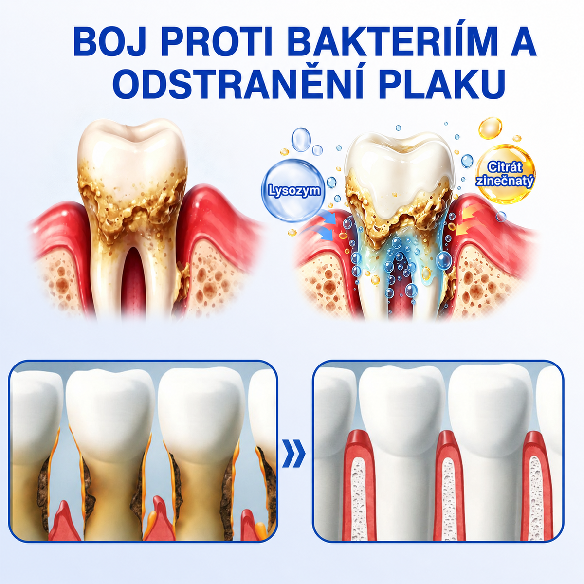 🦷 𝐏𝐮𝐫𝐚𝐂𝐮𝐫𝐞®  𝐎𝐛𝐧𝐨𝐯𝐚 𝐝á𝐬𝐧í 𝐩𝐚𝐫𝐨𝐝𝐨𝐧𝐭á𝐥𝐧í 𝐨𝐩𝐫𝐚𝐯𝐧ý 𝐠𝐞𝐥