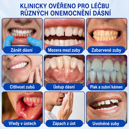 🦷 𝐏𝐮𝐫𝐚𝐂𝐮𝐫𝐞®  𝐎𝐛𝐧𝐨𝐯𝐚 𝐝á𝐬𝐧í 𝐩𝐚𝐫𝐨𝐝𝐨𝐧𝐭á𝐥𝐧í 𝐨𝐩𝐫𝐚𝐯𝐧ý 𝐠𝐞𝐥