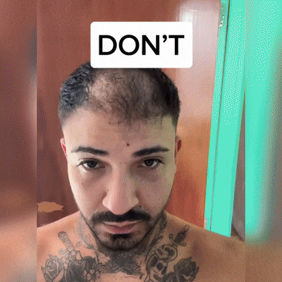 🍌𝐘𝐀𝐈𝐈𝐄𝐎® 𝑭á𝒋𝒅𝒂𝒍𝒐𝒎𝒎𝒆𝒏𝒕𝒆𝒔 𝑴𝒊𝒌𝒓𝒏💛 𝑹𝒆𝒏𝒅𝒔𝒛𝒆𝒓 Hluboce působící blokování DHT, reaktivace vlasových folikulů a viditelný růst vlasů